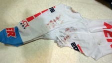 Bloody,torn right sleeve - ADM Crashes at Dana Point Grand Prix - 06 May 2012